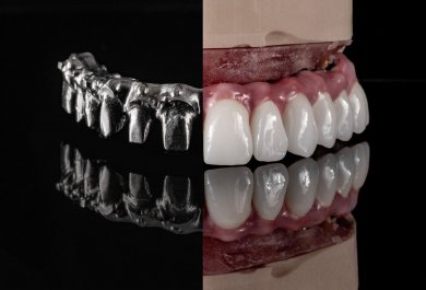 Prace na konstrukcji multiunit